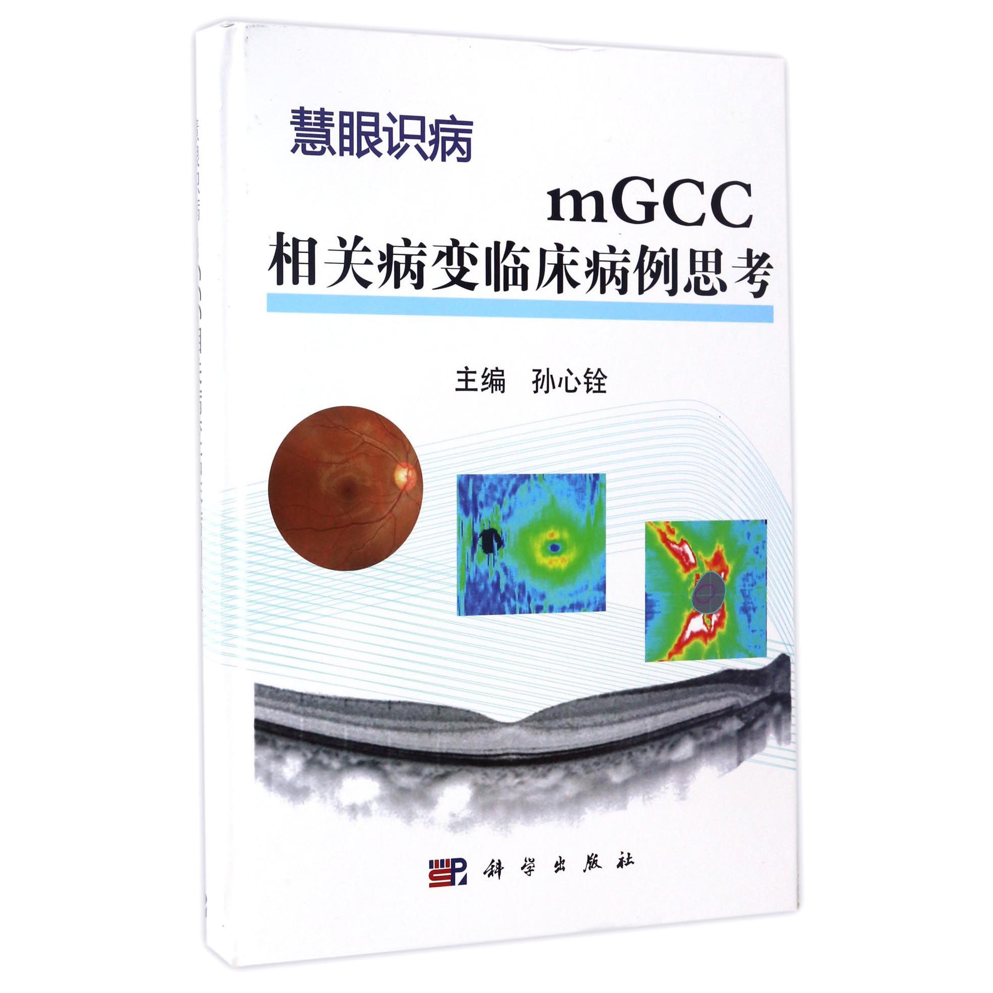mGCC相关病变临床病例思考(慧眼识病)(精)