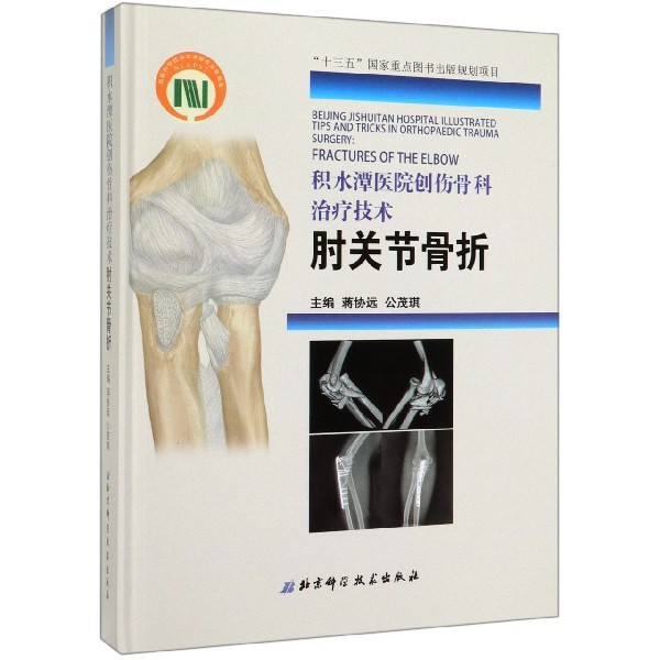 积水潭医院创伤骨科治疗技术(肘关节骨折)(精)