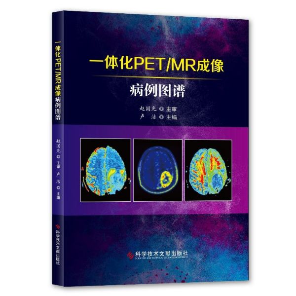 一体化PETMR成像病例图谱