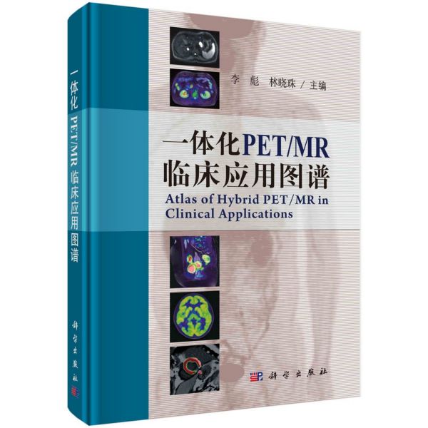 一体化PETMR临床应用图谱(精)