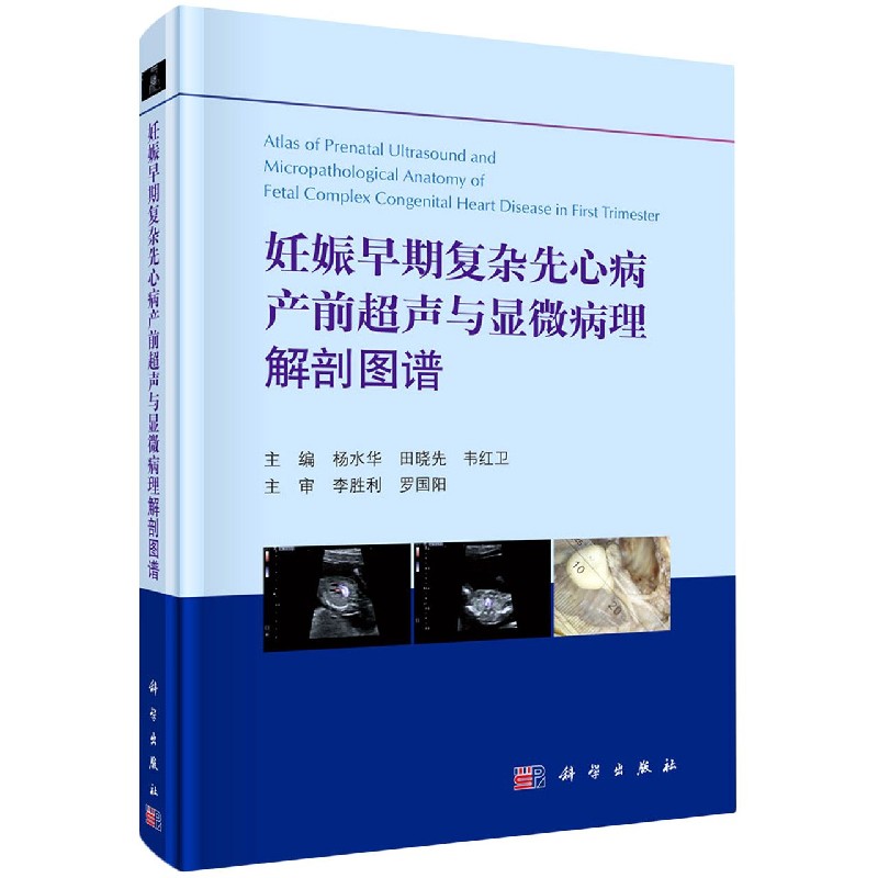 妊娠早期复杂先心病产前超声与显微病理解剖图谱（精）