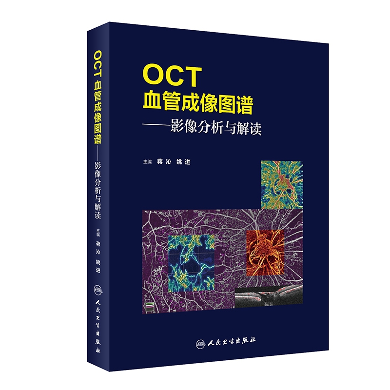 OCT血管成像图谱——影像分析与解读