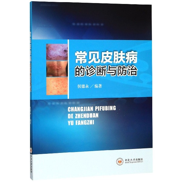 常见皮肤病的诊断与防治