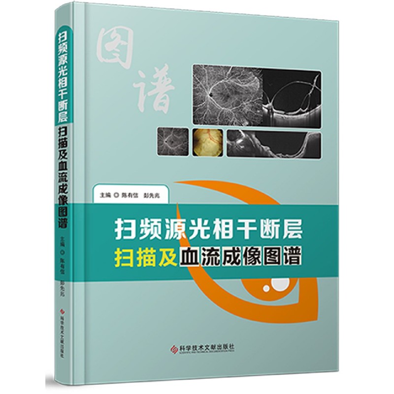 扫频源光相干断层扫描及血流成像图谱（精）