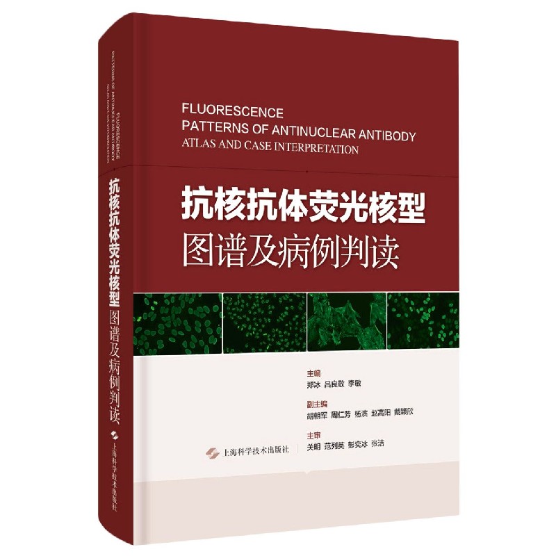 抗核抗体荧光核型图谱及病例判读（精）