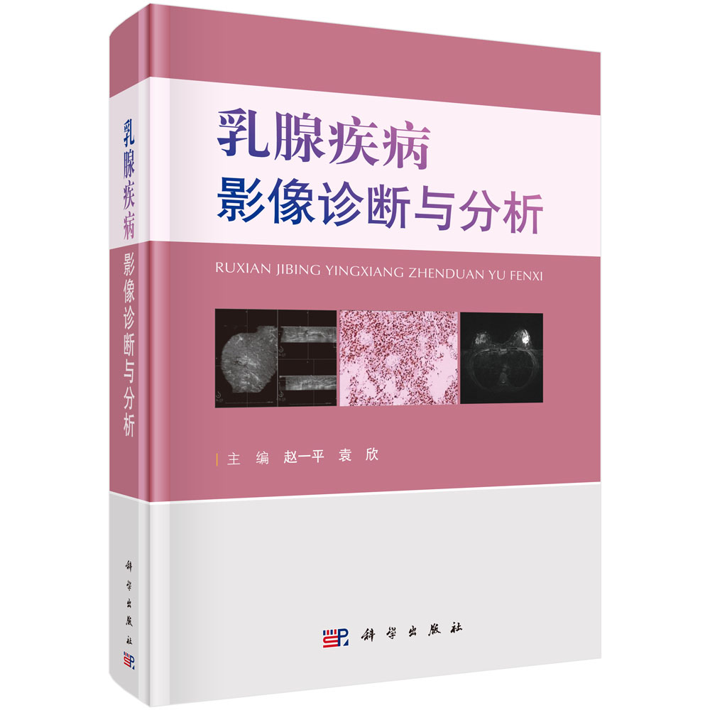 乳腺疾病影像诊断与分析（精）