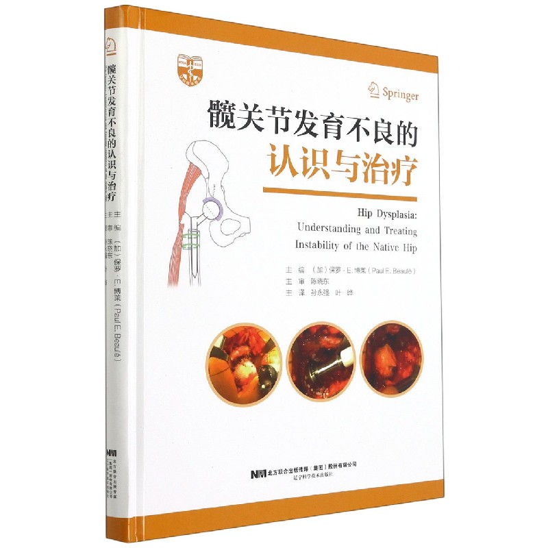 髋关节发育不良的认识与治疗