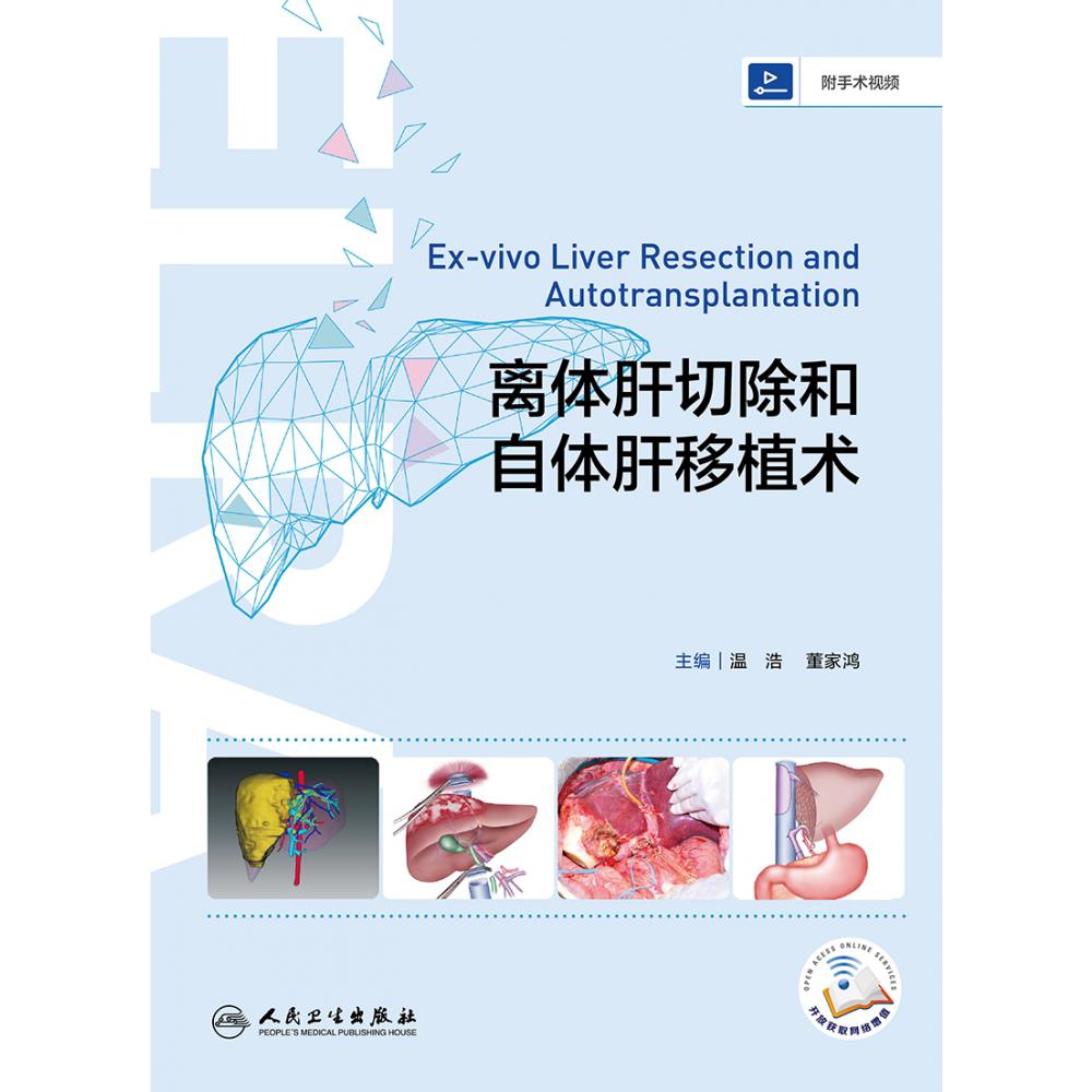离体肝切除和自体肝移植术