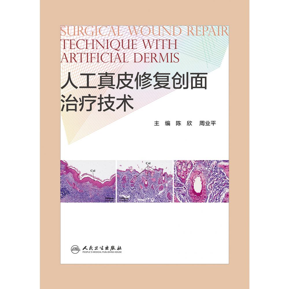 人工真皮修复创面治疗技术