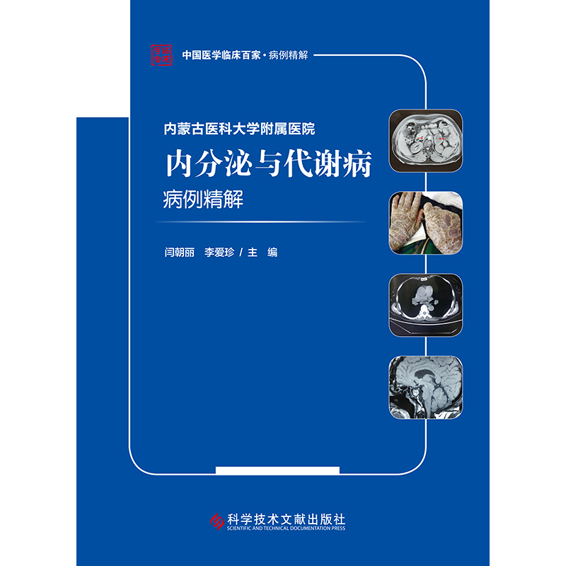 内蒙古医科大学附属医院内分泌与代谢病病例精解/中国医学临床百家