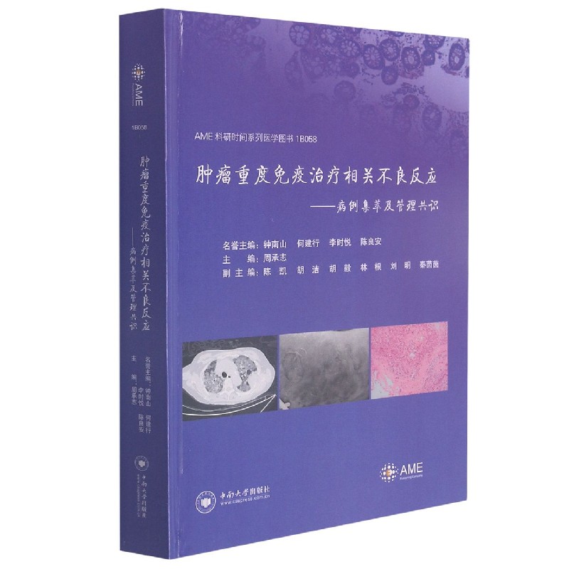 肿瘤重度免疫治疗相关不良反应——病例集萃及管理共识