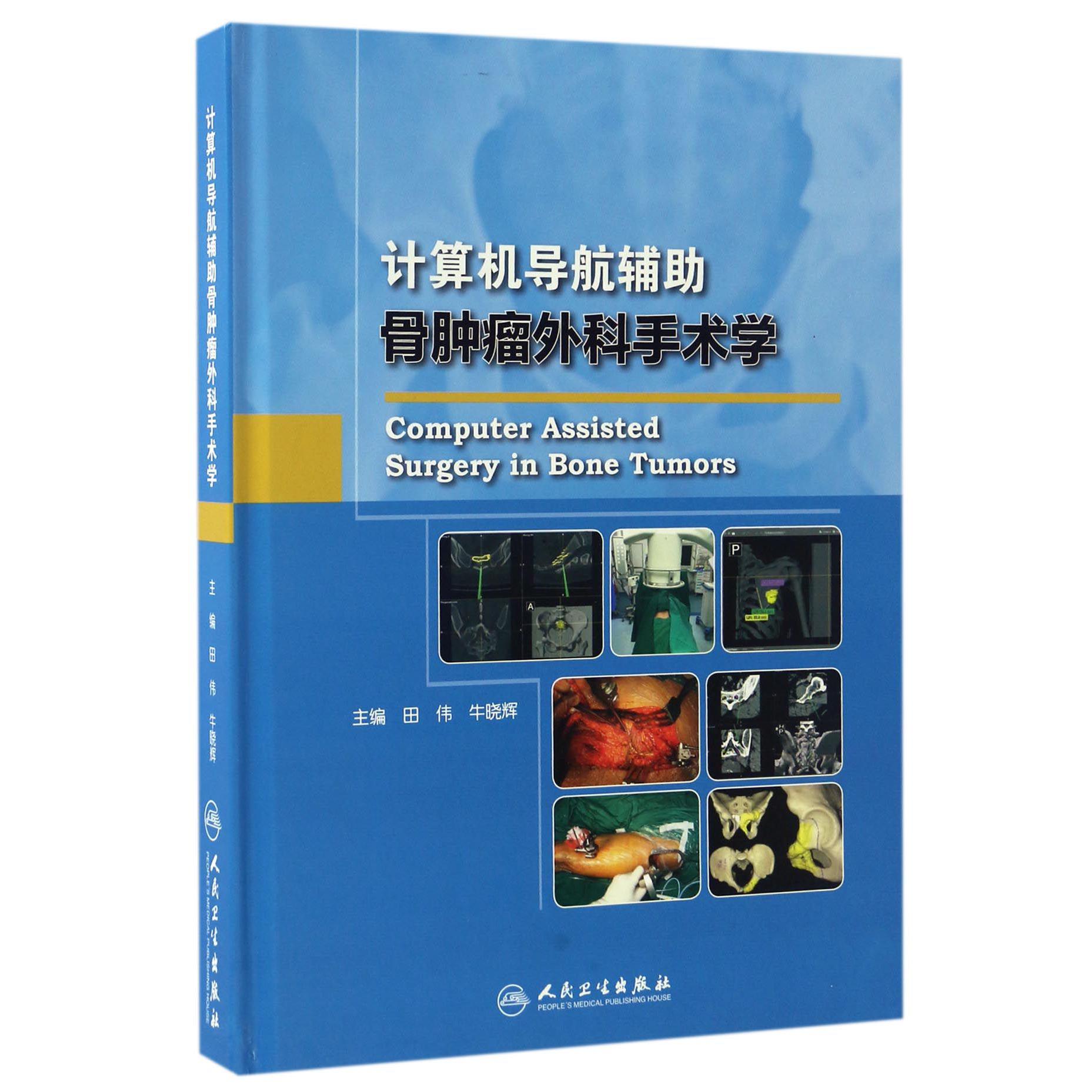 计算机导航辅助骨肿瘤外科手术学（精）