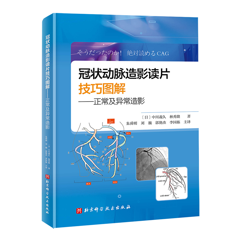 冠状动脉造影读片技巧图解：正常及异常造影