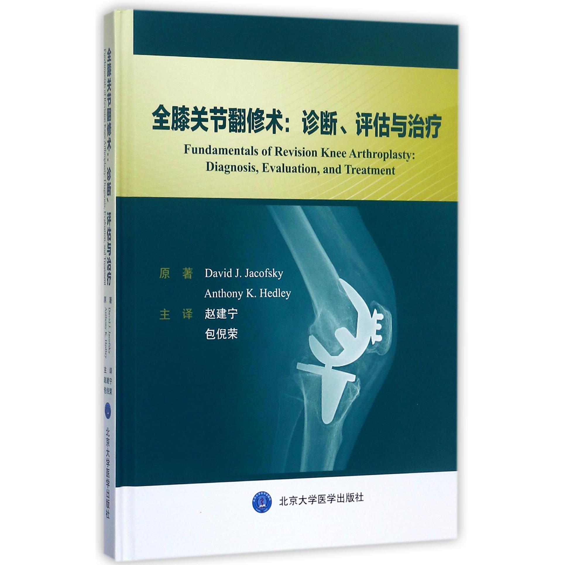 全膝关节翻修术--诊断评估与治疗(精)