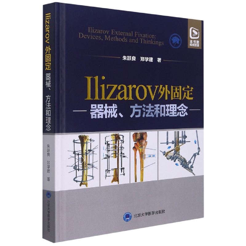 Ilizarov外固定—器械、方法和理念