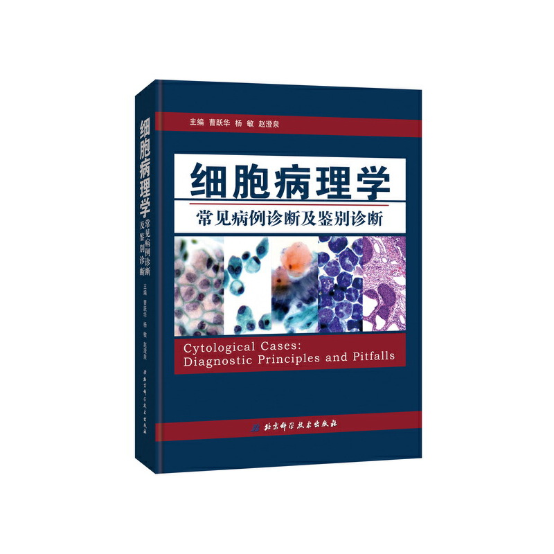 细胞病理学常见病例诊断及鉴别诊断（精）