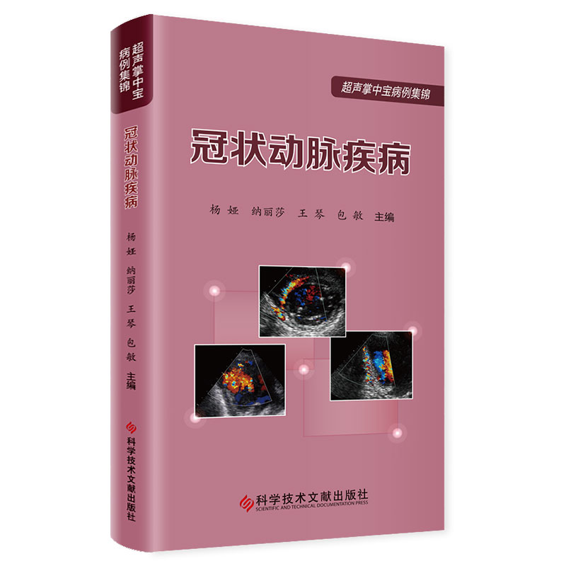 冠状动脉疾病