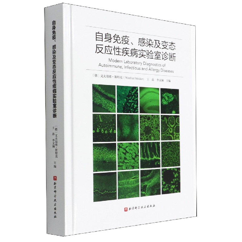 自身免疫、感染及变态反应性疾病实验室诊断