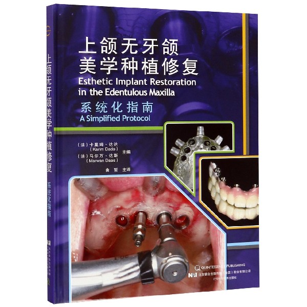 上颌无牙颌美学种植修复系统化指南(精)