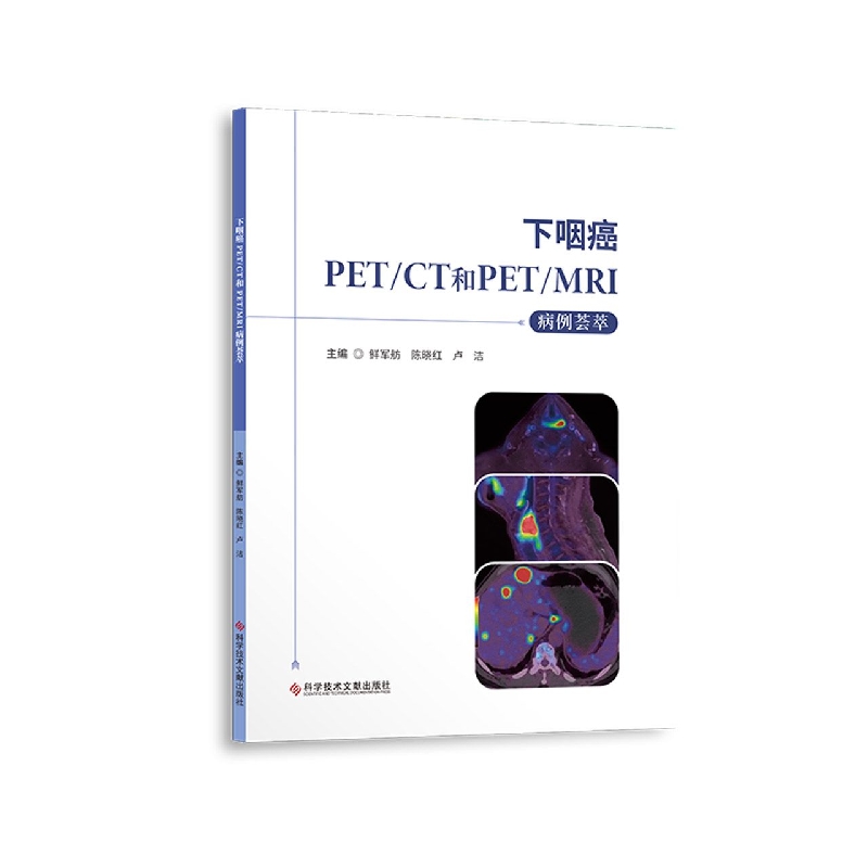 下咽癌PET/CT和PET/MRI病例荟萃