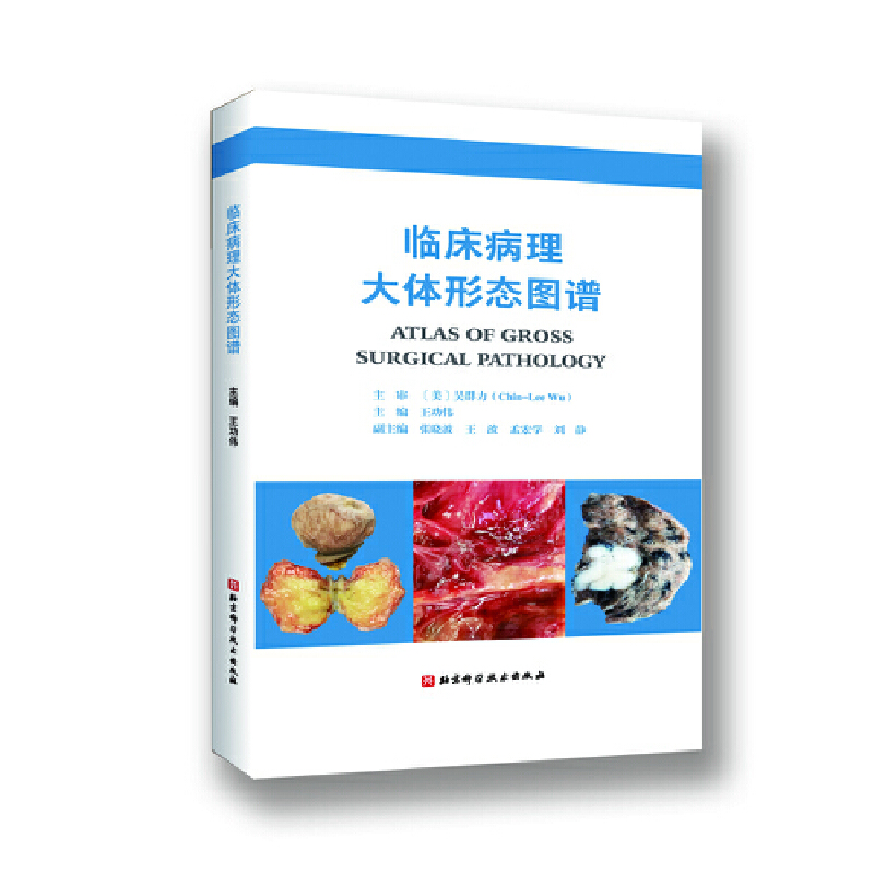 临床病理大体形态图谱(精)
