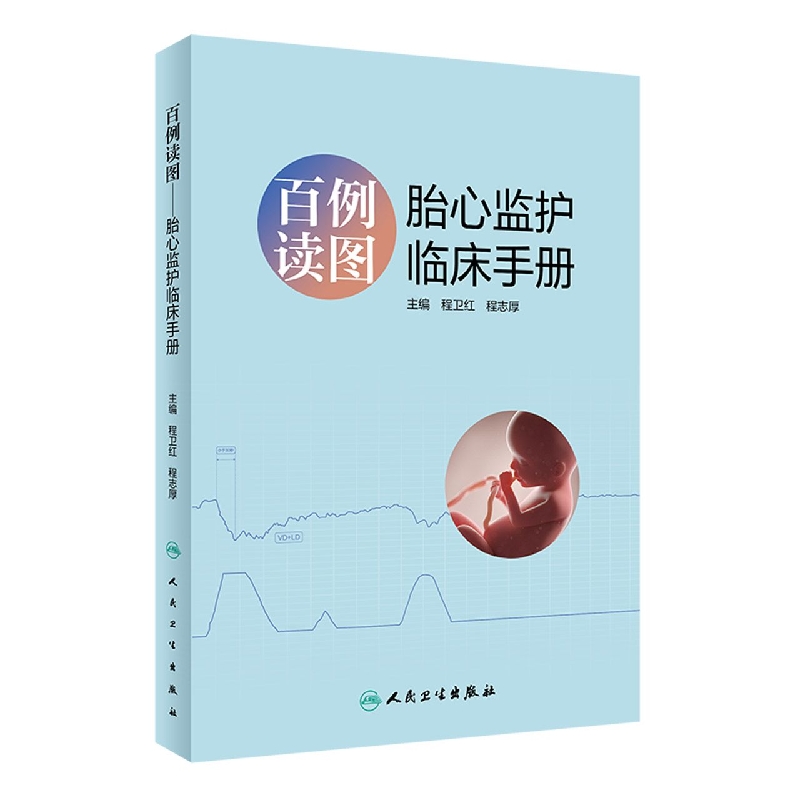 百例读图——胎心监护临床手册