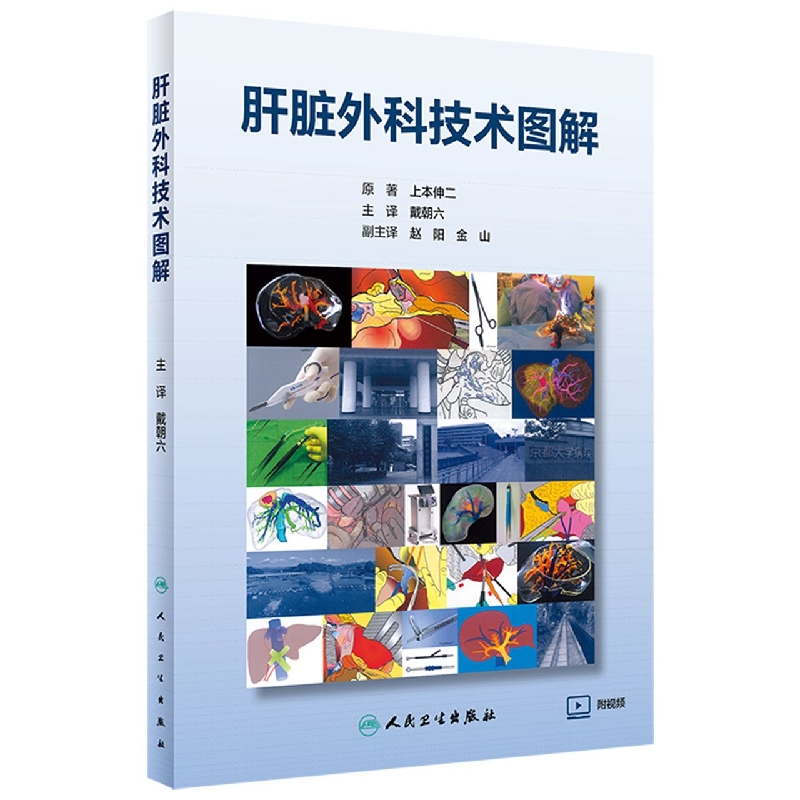 肝脏外科技术图解（翻译版/配增值）
