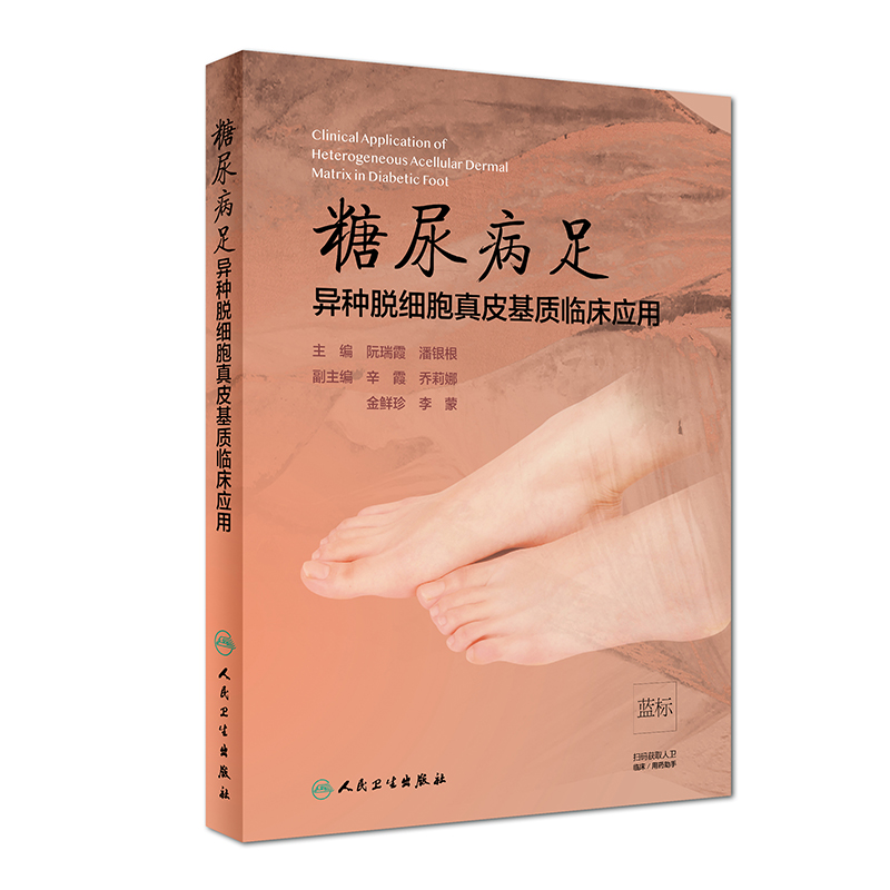 糖尿病足异种脱细胞真皮基质临床应用
