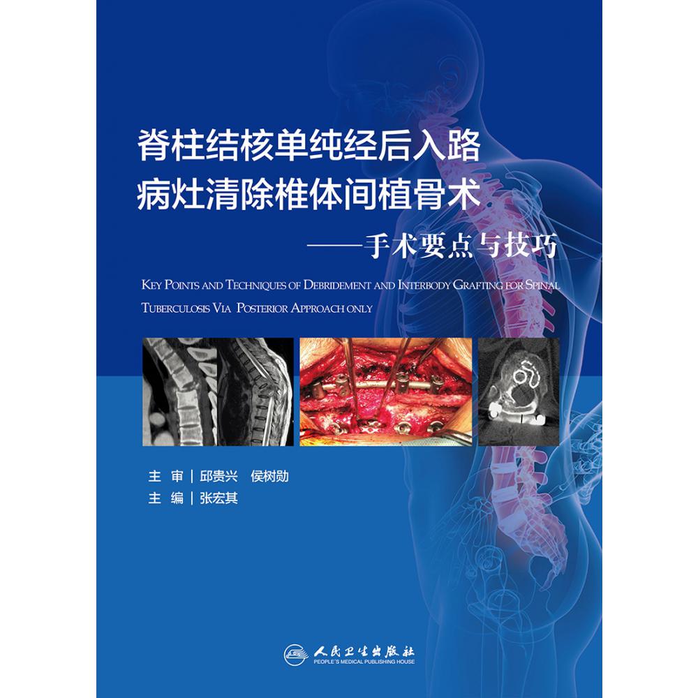 脊柱结核单纯经后入路病灶清除与椎体间植骨术——手术要点与技巧（配增值）