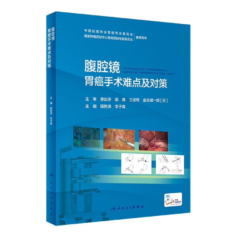腹腔镜胃癌手术难点及对策（配增值）