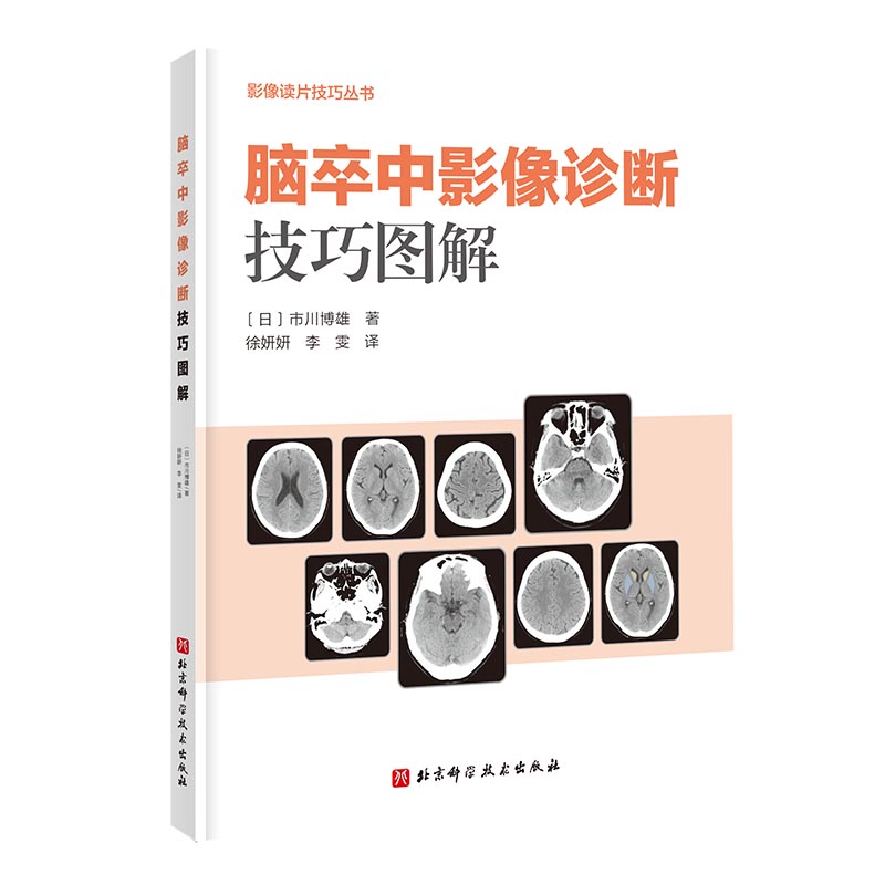 脑卒中影像诊断技巧图解