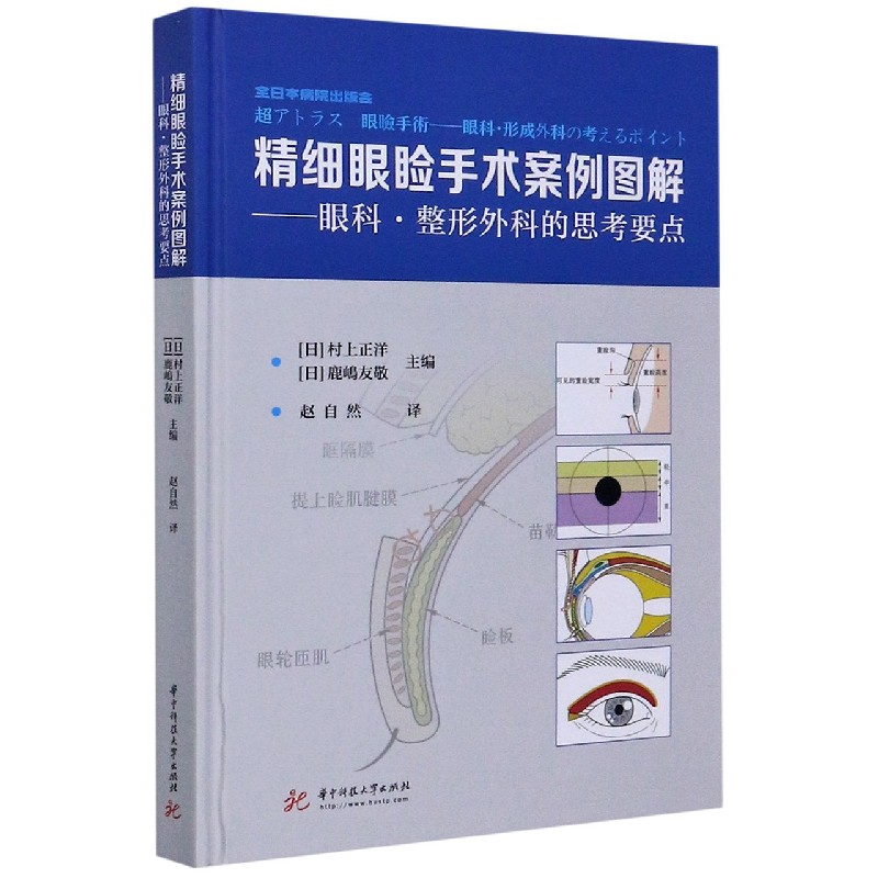 精细眼睑手术案例图解--眼科整形外科的思考要点(精)