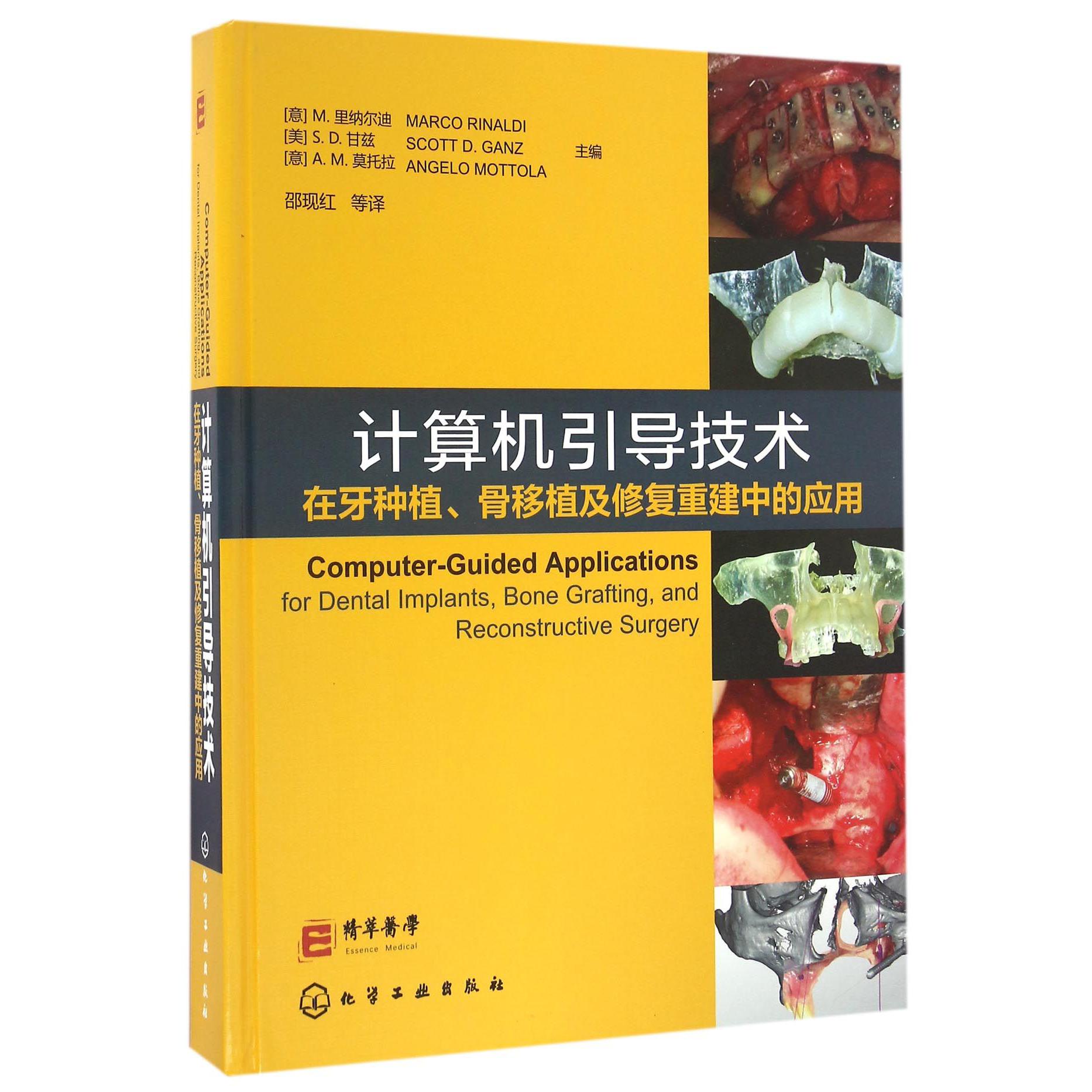 计算机引导技术在牙种植骨移植及修复重建中的应用（精）