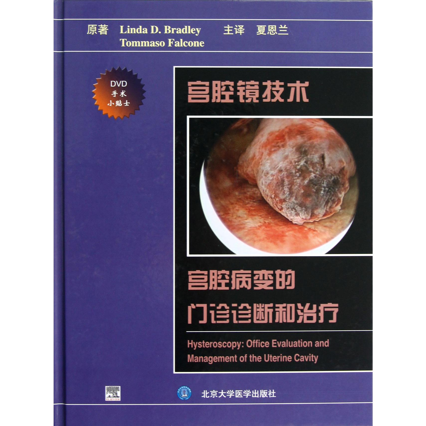 宫腔镜技术（附光盘宫腔病变的门诊诊断和治疗）（精）