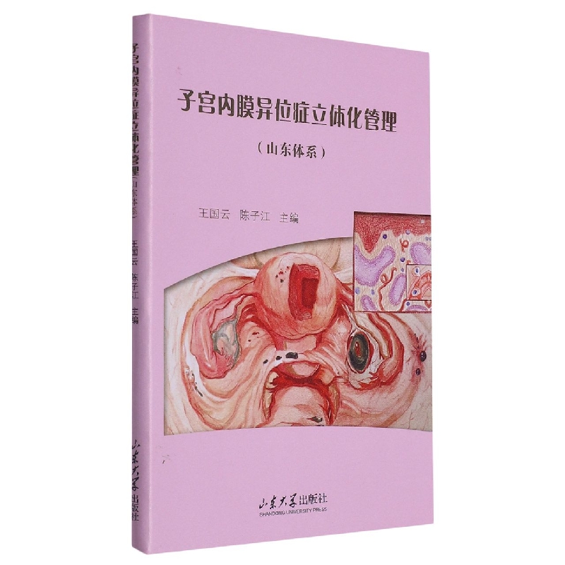子宫内膜异位症立体化管理(山东体系)