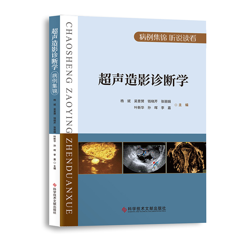 超声造影诊断学