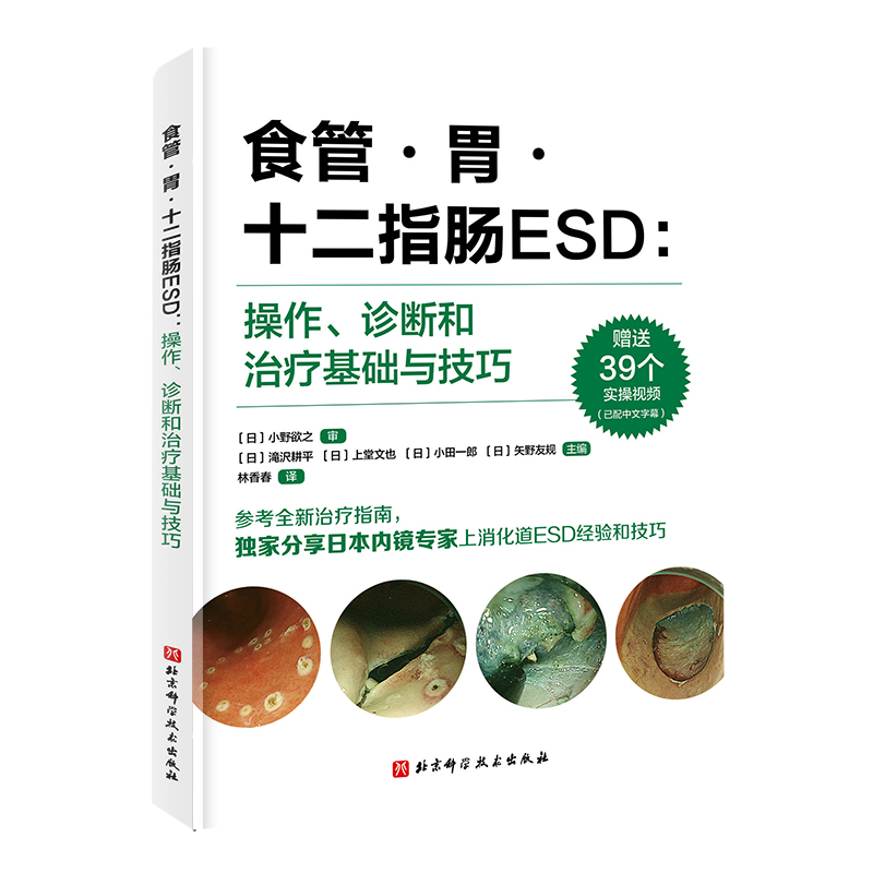 食管·胃·十二指肠ESD : 操作、诊断和治疗基础与技巧