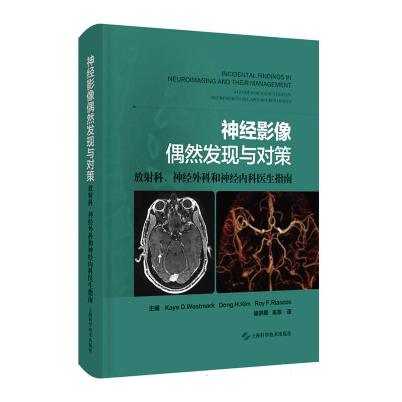 神经影像偶然发现与对策——放射科、神经外科和神经内科医生指南