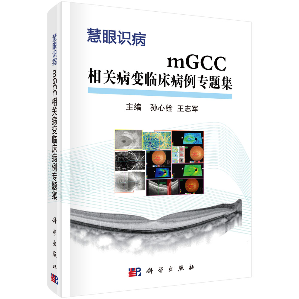 mGCC相关病变临床病例专题集(慧眼识病)(精)