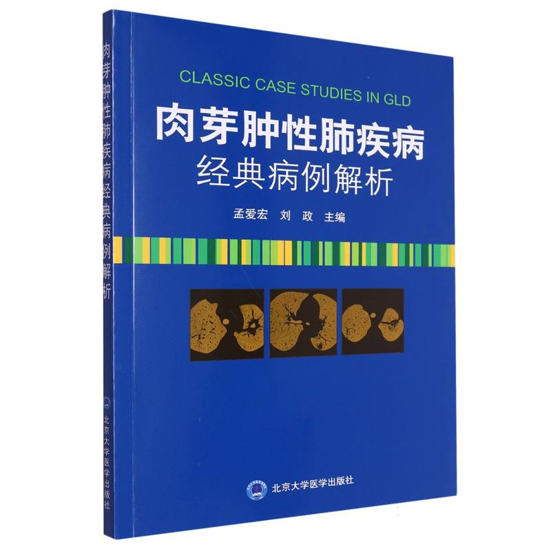 肉芽肿性肺疾病经典病例解析