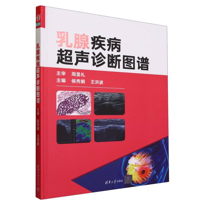 乳腺疾病超声诊断图谱
