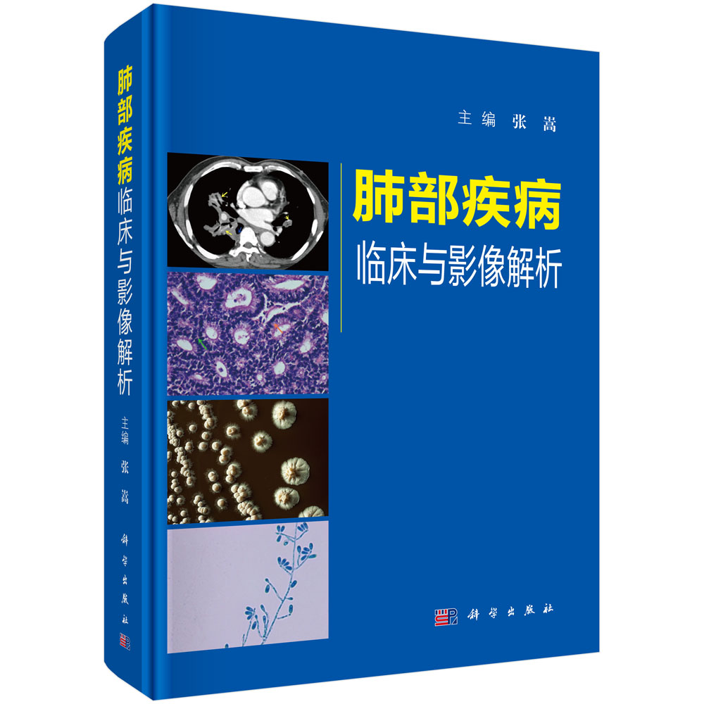 肺部疾病临床与影像解析（精）