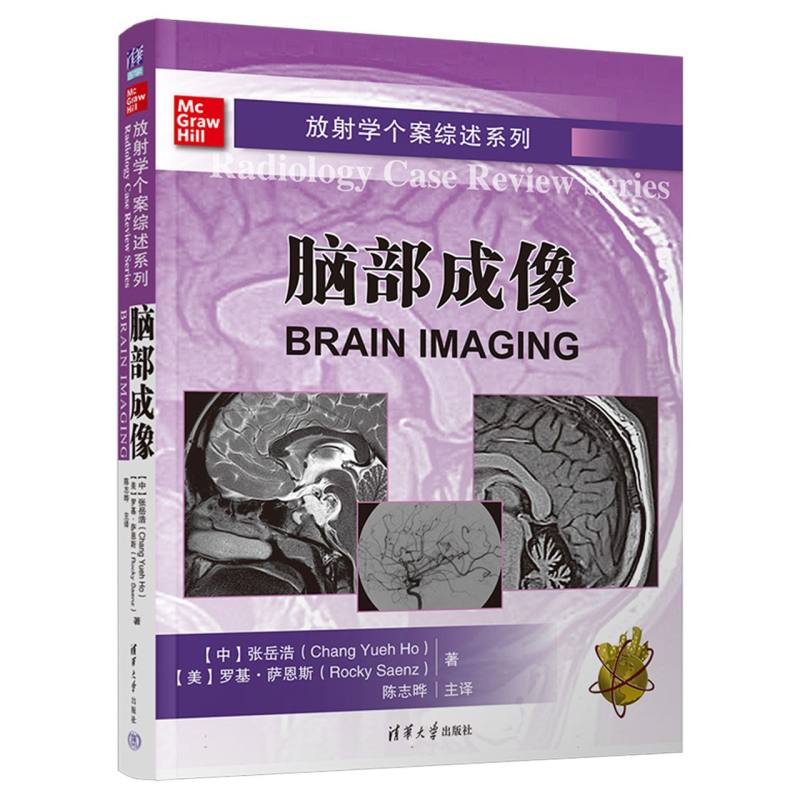 脑部成像/放射学个案综述系列