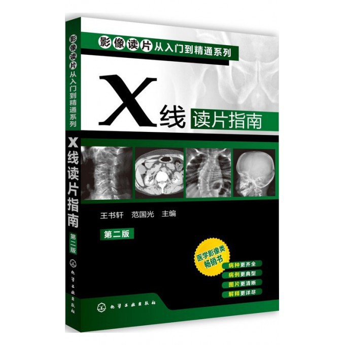 X线读片指南(第2版)/影像读片从入门到精通系列