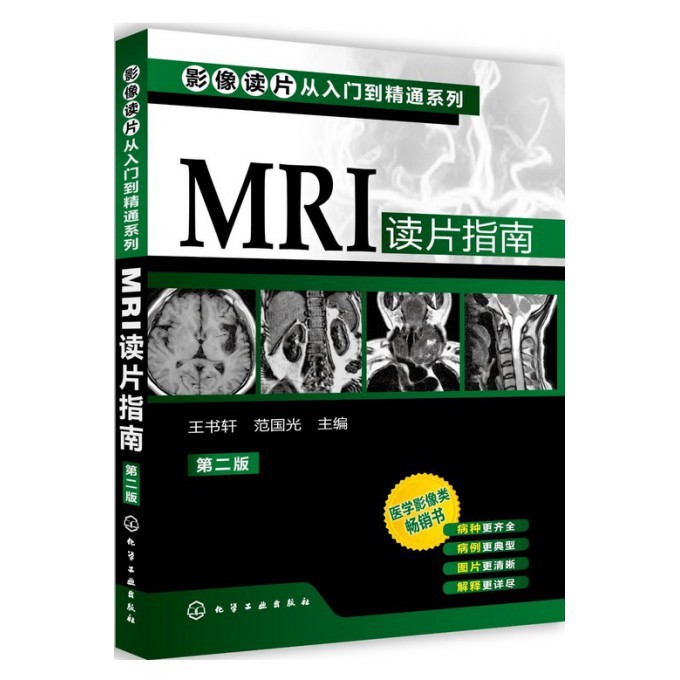 MRI读片指南(第2版)/影像读片从入门到精通系列