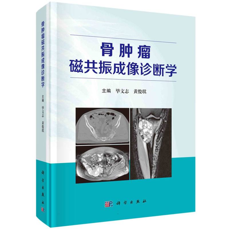 骨肿瘤磁共振成像诊断学