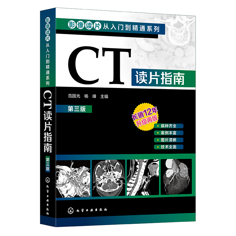 CT读片指南(第3版)/影像读片从入门到精通系列