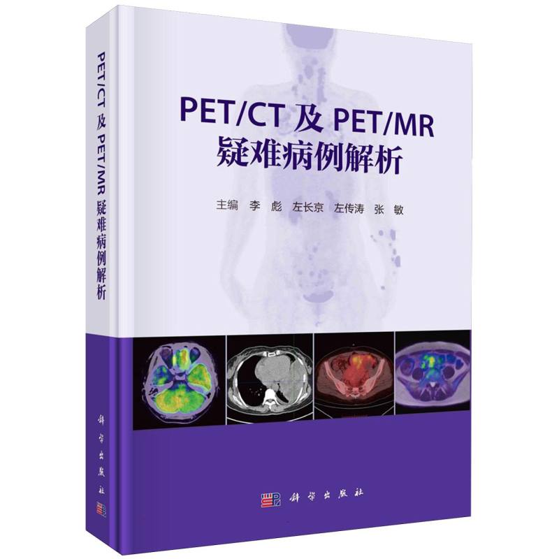 PETCT及PETMR疑难病例解析