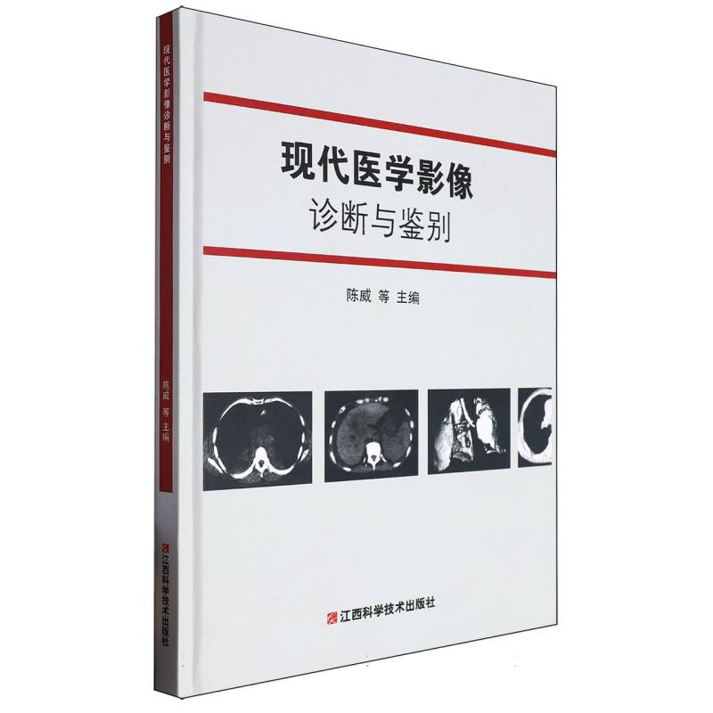现代医学影像诊断与鉴别