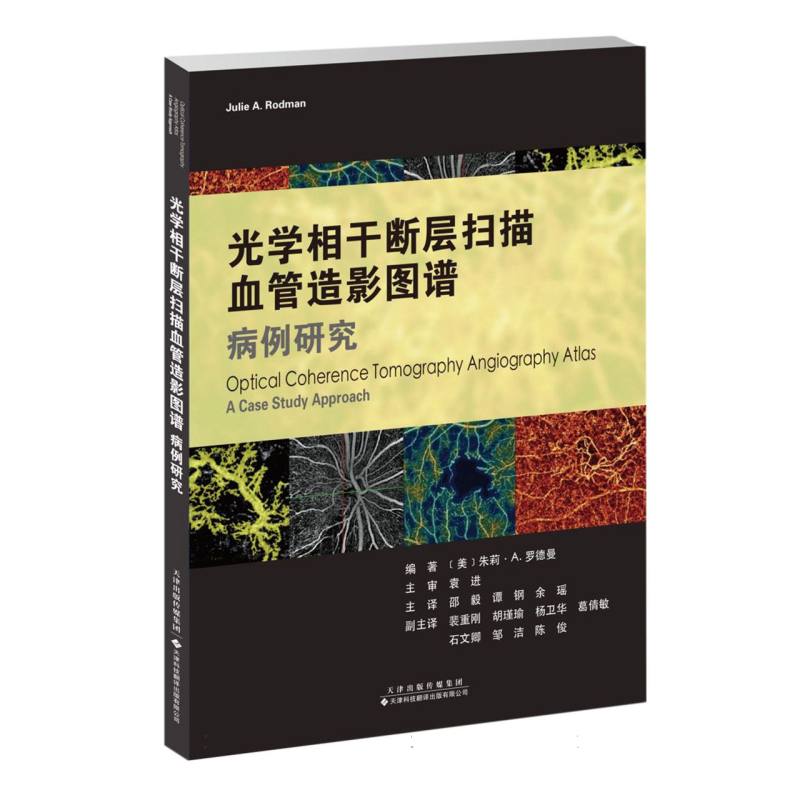 光学相干断层扫描血管造影图谱：病例研究...